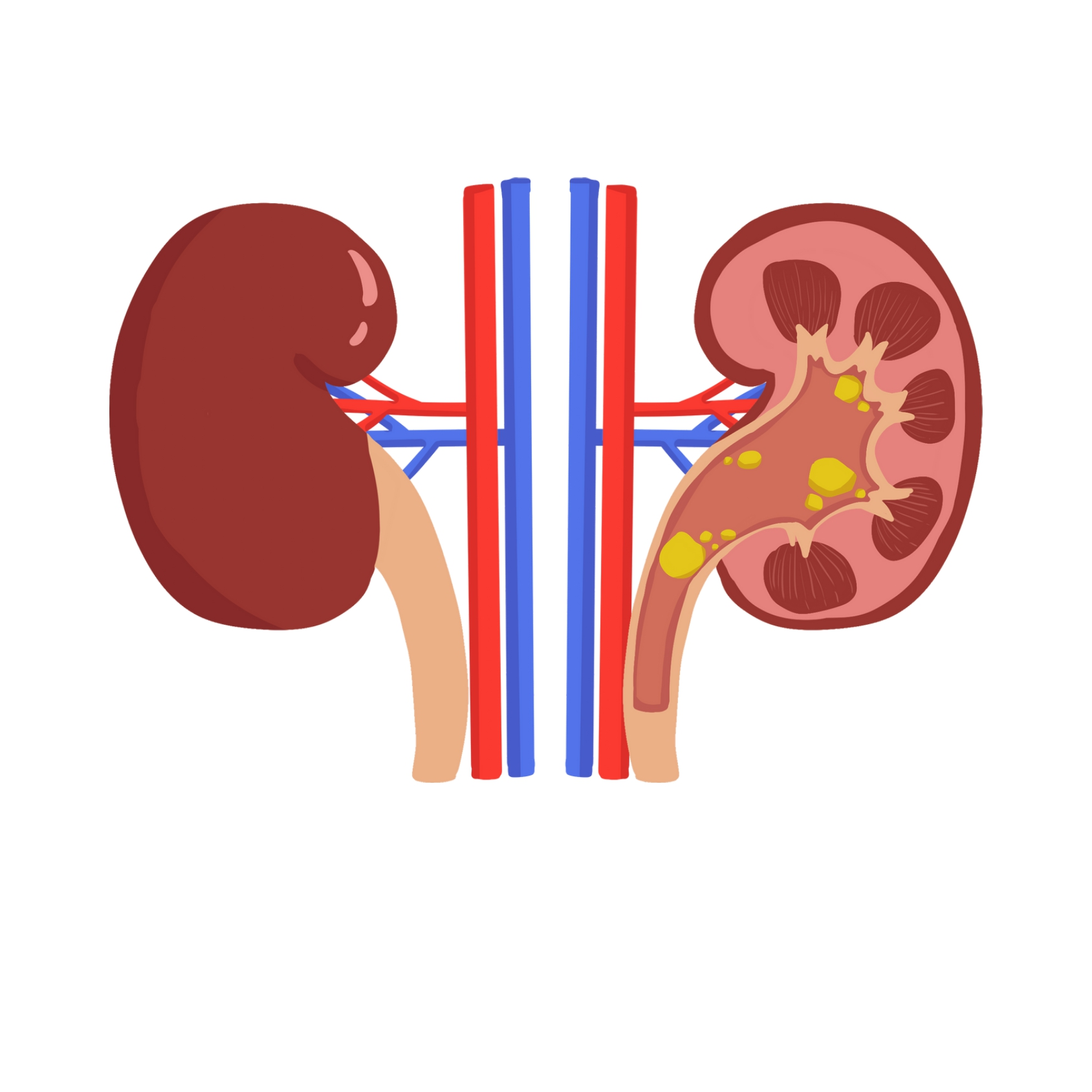 kidneycareimg Image