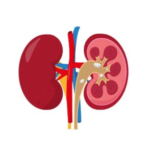 Polycystic Kidney Disease Image